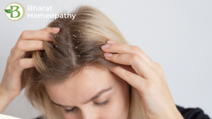 How a Natural Treatment for Psoriasis Can Change Your Life